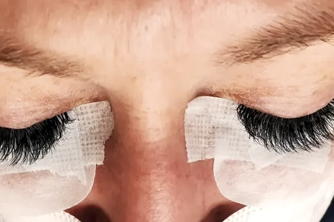 A lash set in progress at the lash line, seen from above, eyes closed on under-eye pads